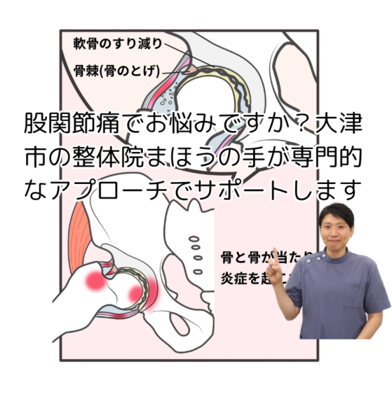 キャッチ画像