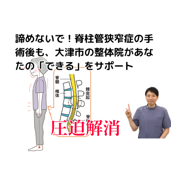 キャッチ画像