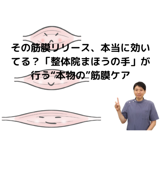キャッチ画像