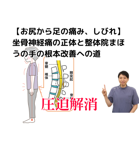 キャッチ画像