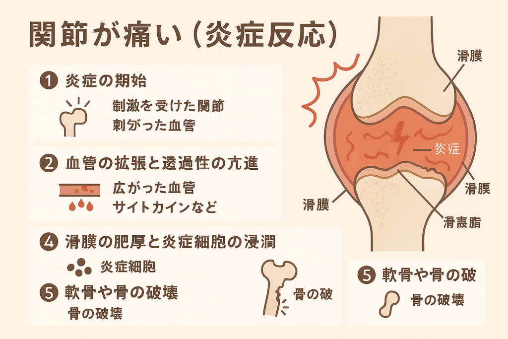 関節の炎症のイラスト