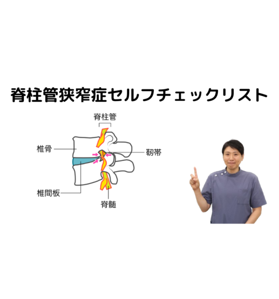 キャッチ画像