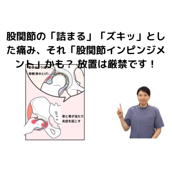 キャッチ画像