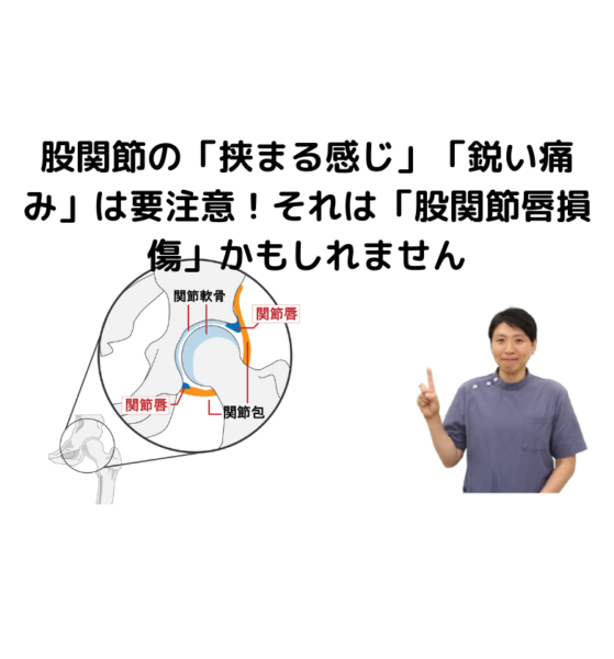 キャッチ画像