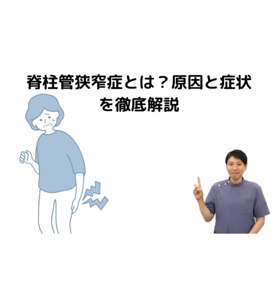 キャッチ画像
