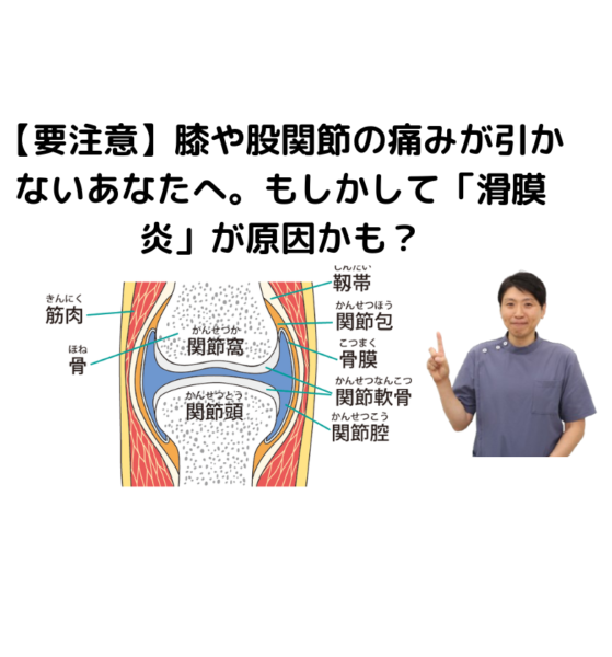 キャッチ画像