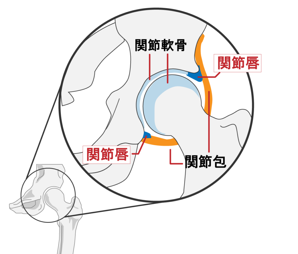 股関節イラスト
