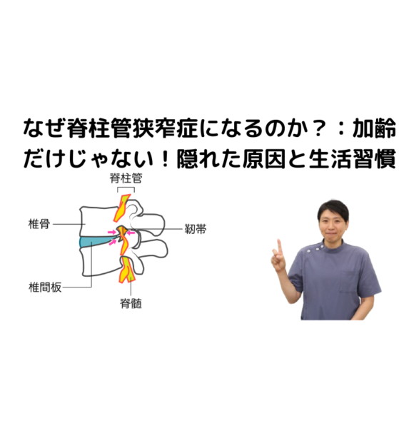 キャッチ画像