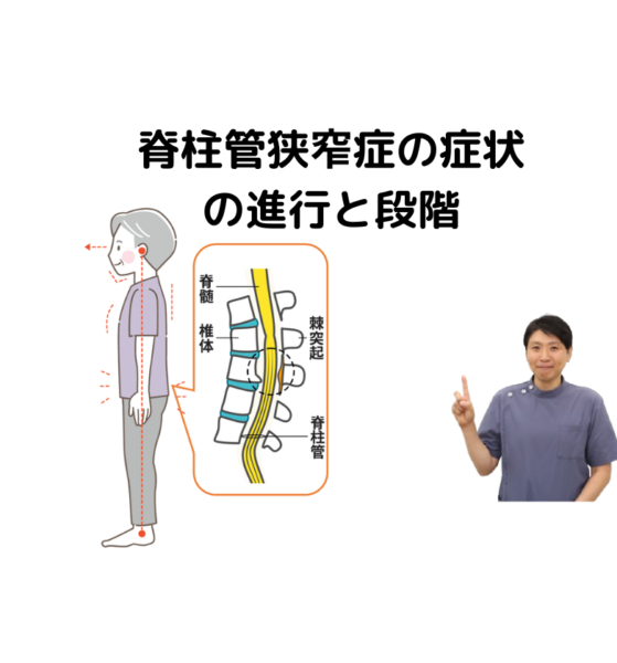 キャッチ画像