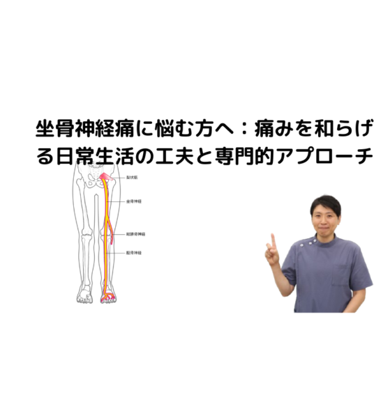 キャッチ画像