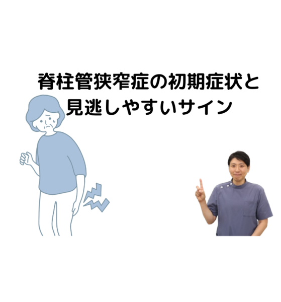 キャッチ画像
