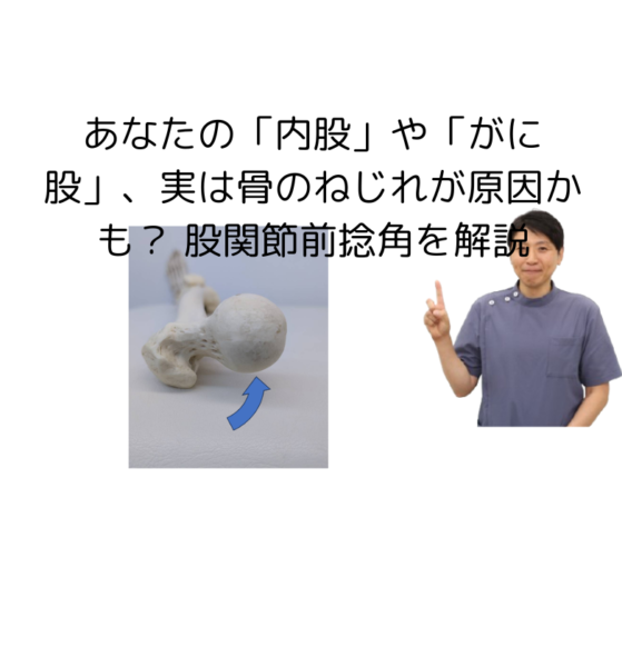 キャッチ画像