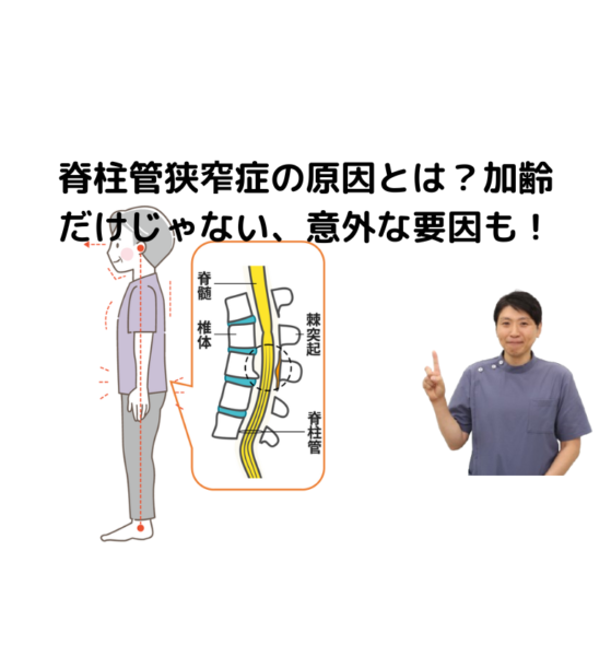 キャッチ画像