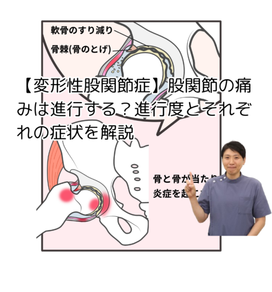 キャッチ画像