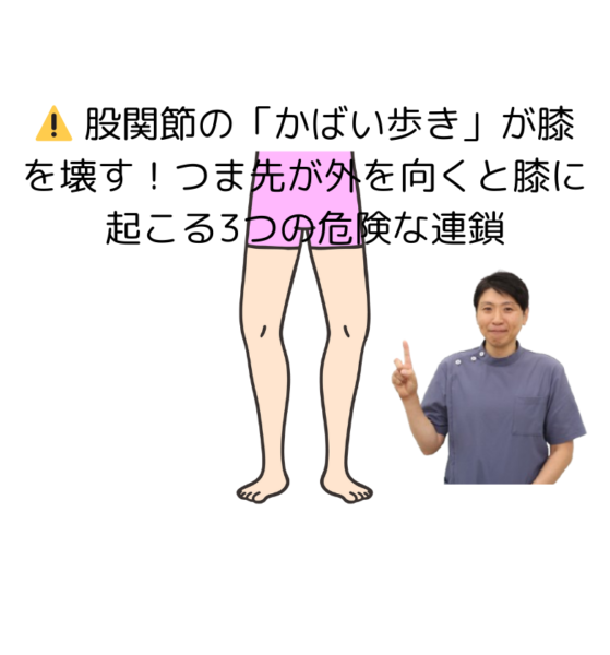 キャッチ画像