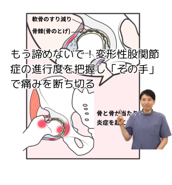 キャッチ画像