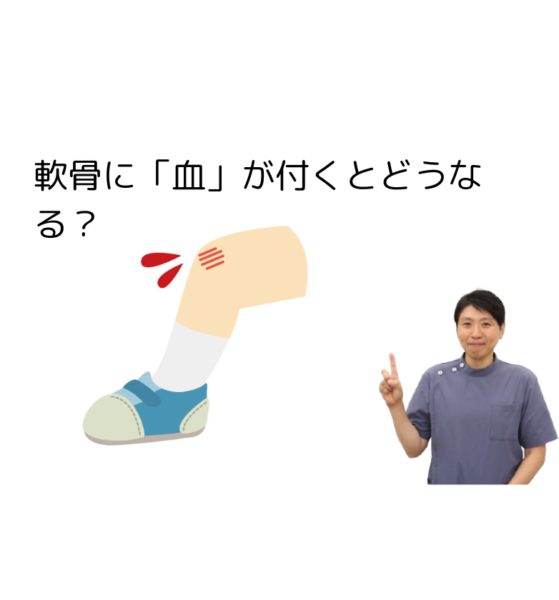 キャッチ画像