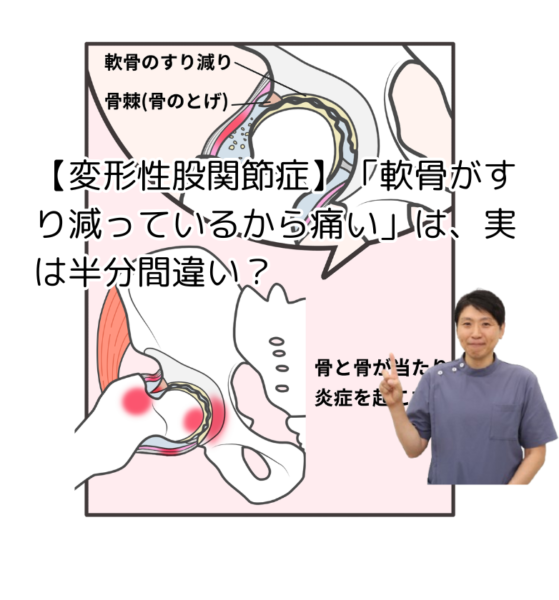 キャッチ画像