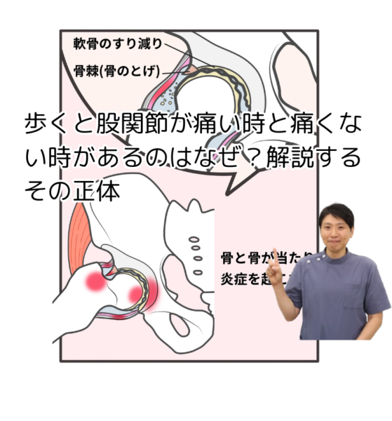 キャッチ画像